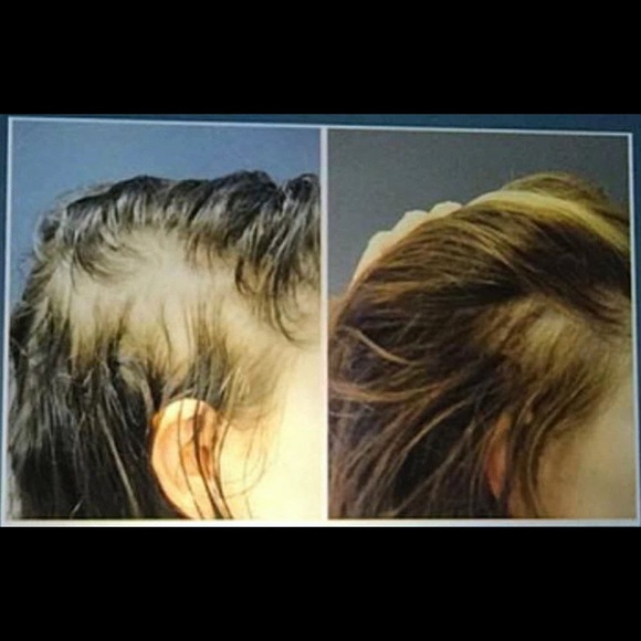 RVL - Ultra Repairing Advanced Haircare Shampoo - Picture 3 of 3